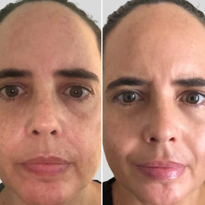Aphrodite LED Face Mask